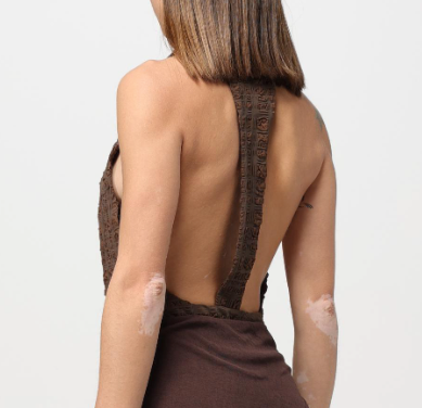 Nanushka Irina Bodysuit